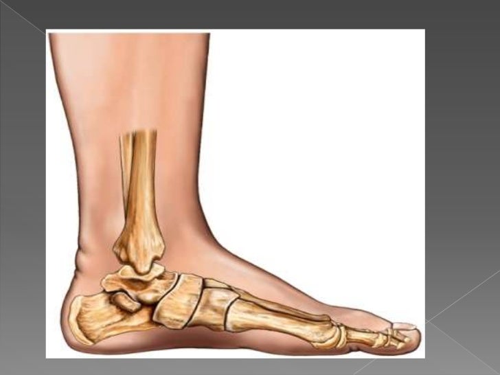 Adult Acquired Flat Feet