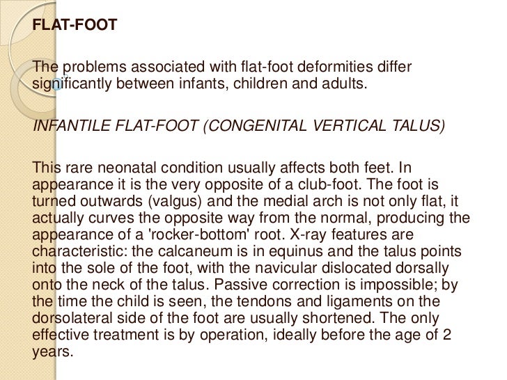 Acquired Flat Foot