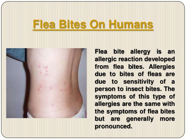 Flea Bites & Treatment- What Do Flea Bites Look Like on Humans