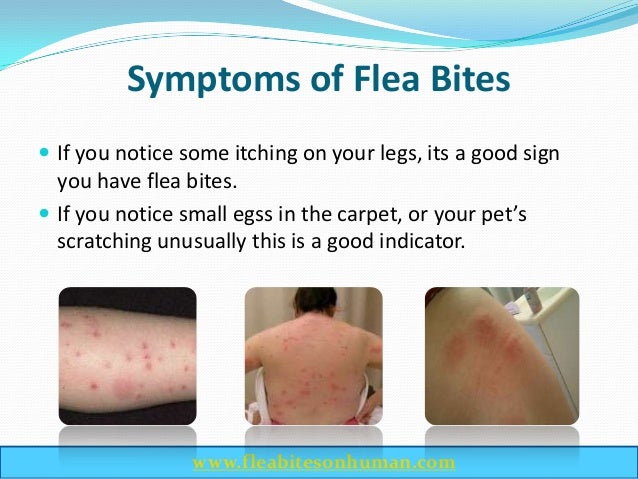 infected flea bite