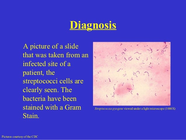 a description of necrotizing fasciitis the flesh eating disease a description of necrotizing fasciitis the flesh eating disease