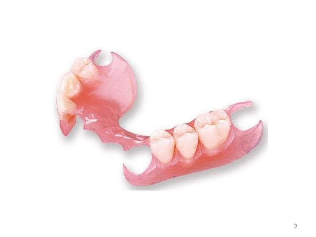 denture presentation