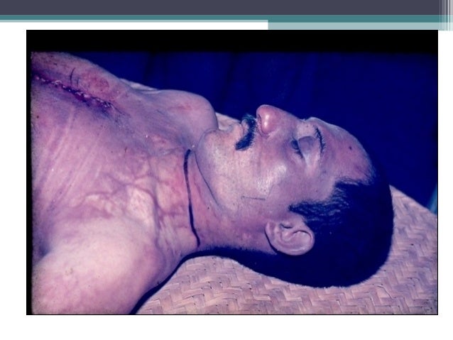 Asphyxia From FME by Dr Yaseen Mohammad for 3rd year MBBS Students