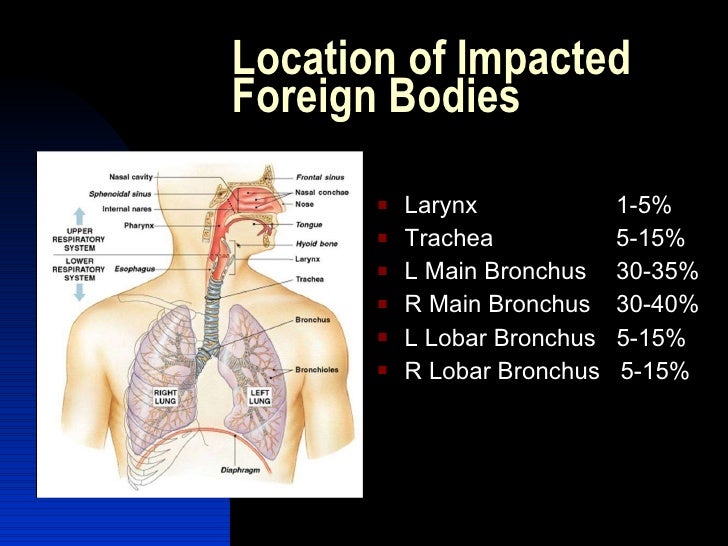 Foreign body aspiration
