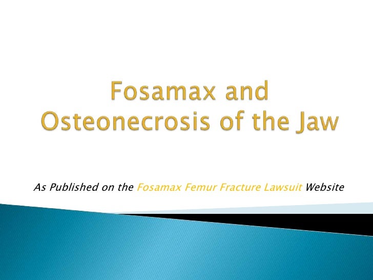 Fosamax and osteonecrosis of the jaw