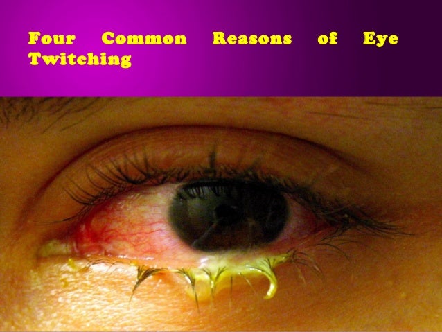 Four Common Reasons Of Eye Twitching