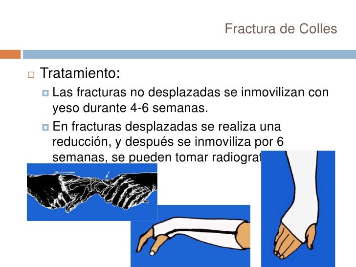 El callista medicinal al hongo del pies
