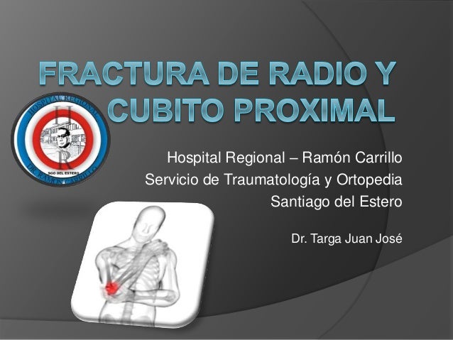 FRACTURA RADIO fractura radio: