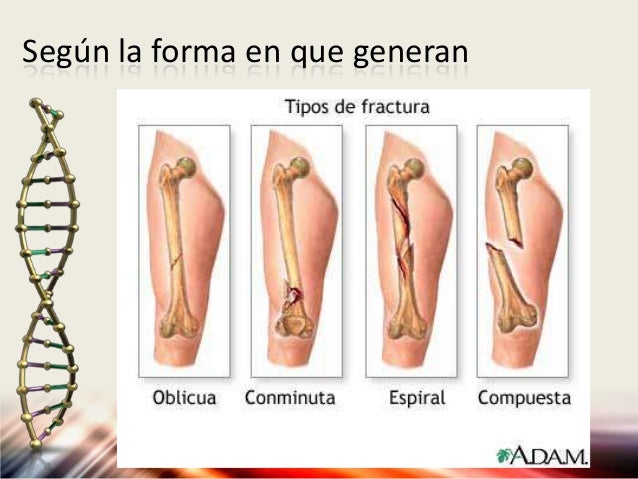 Varikoz sobre los vasos del hígado
