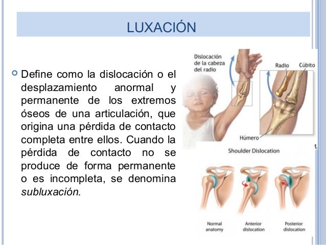 Fracturas Esguinces y Luxaciones