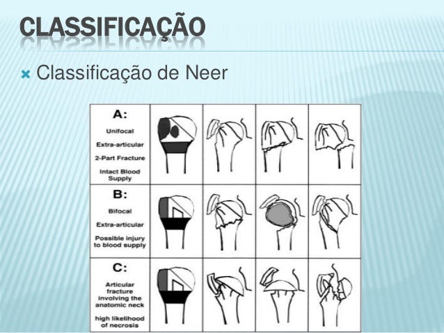 Fraturas dos membros_superiores[1]