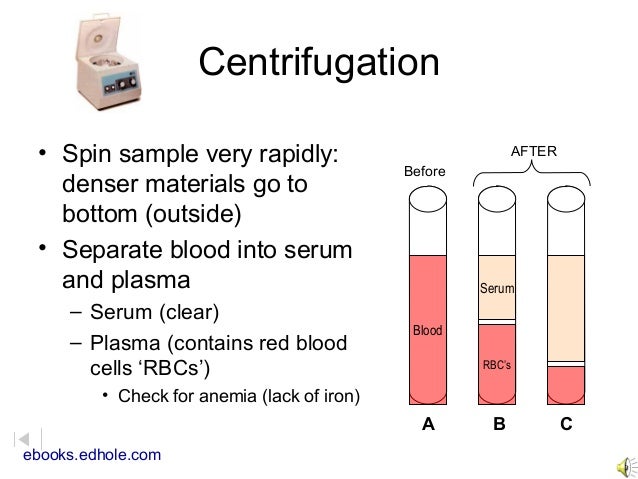 plasma vs serum