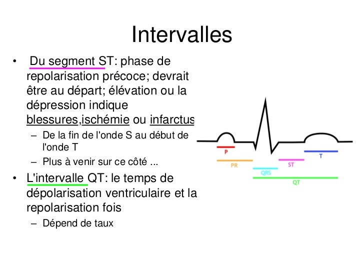 Base ECG et l'interprétation du rythme (French) Symposia