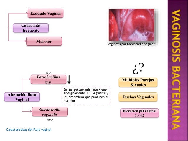 gardnerella-vaginaliz-chto-eto gardnerella-vaginaliz-chto-eto