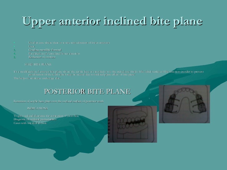 Functional Appliances