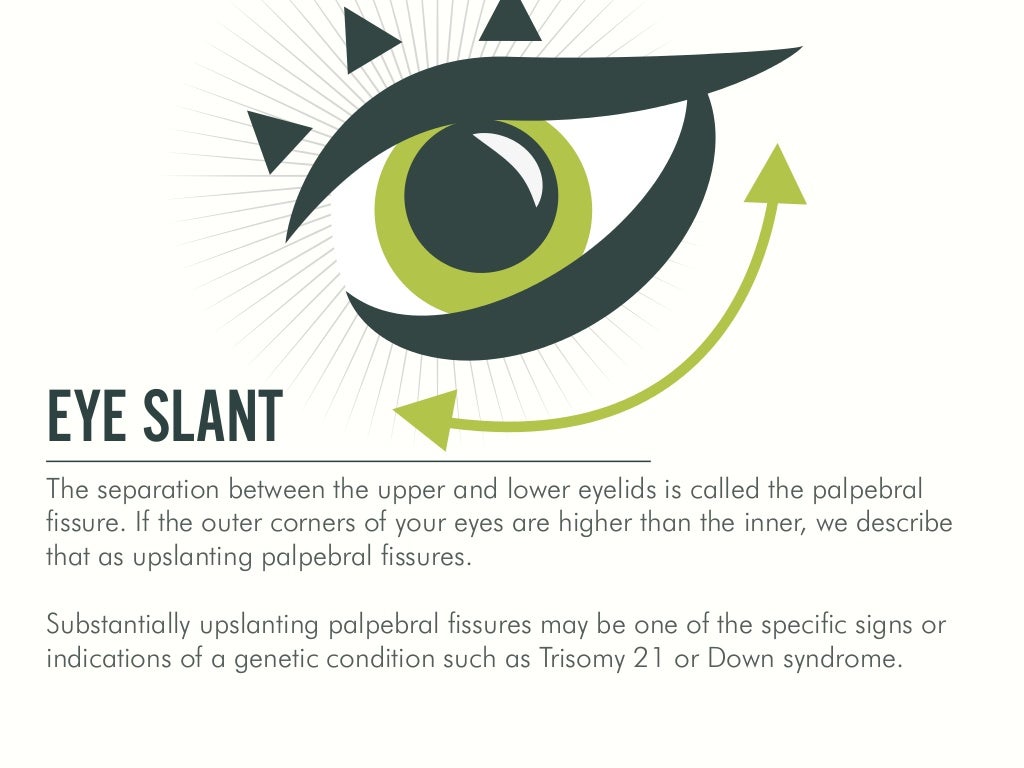 EYE SLANT The separation between