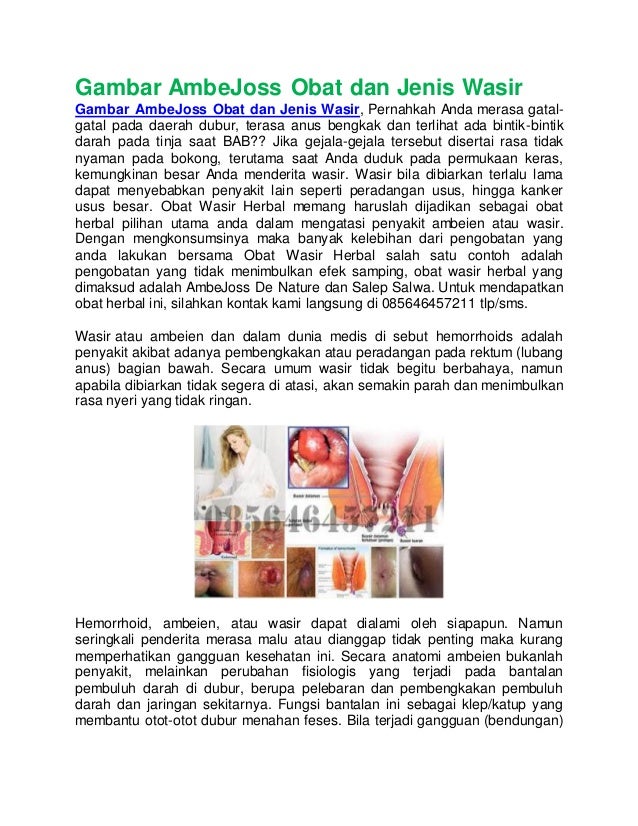 gambar ambe joss obat dan jenis wasir gambar ambe joss obat dan jenis wasir