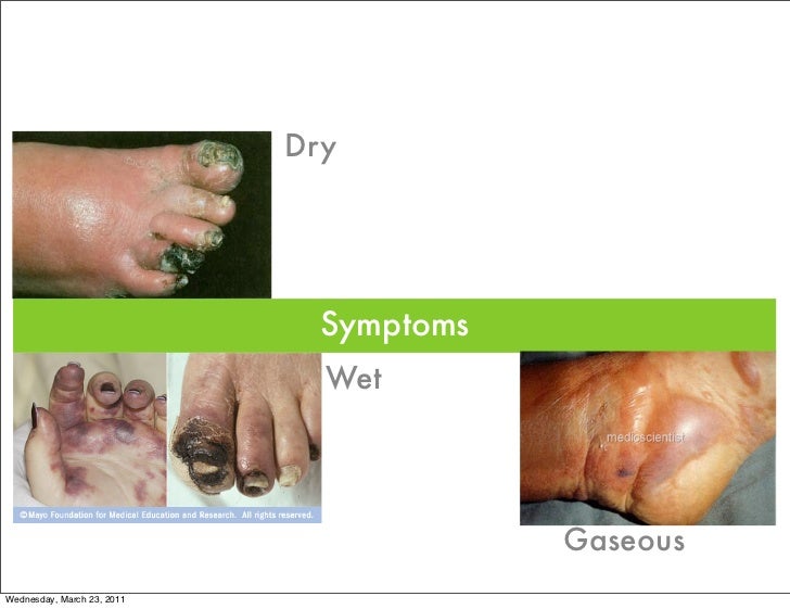 Gangrene symptoms