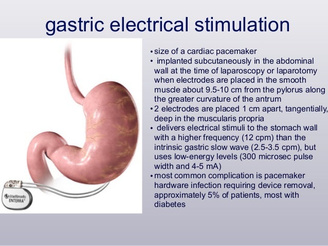 Diabetes And Gastroparesis Specialist For Peds
