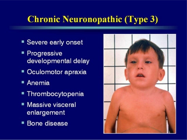 gauchers disease Gaucher disease is a genetic disorder and affects the body's organs and tissues learn about gaucher disease symptoms, testing and treatments. gauchers disease Gaucher disease is a genetic disorder and affects the body's organs and tissues learn about gaucher disease symptoms, testing and treatments.