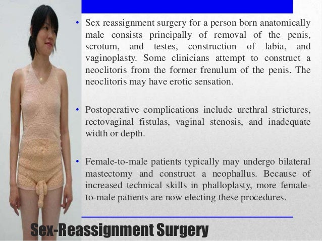 female to male sex change pics 322406 female to male sex change pics 322405