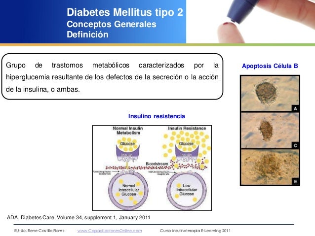 Generalidades diabetes mellitus rené castillo flores 2012 Generalidades diabetes mellitus rené castillo flores 2012