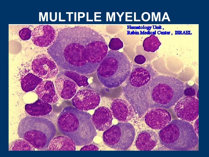 General pathology lecture 7 neoplasms