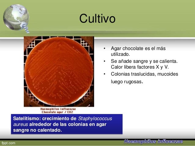 Genero haemophilus i 2015 Genero haemophilus i 2015