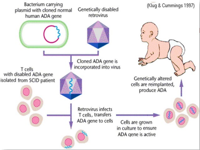 Gene therapy essay