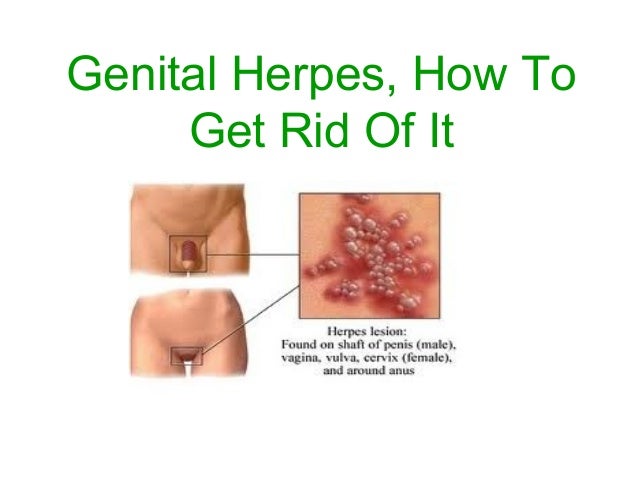herpes on testicles