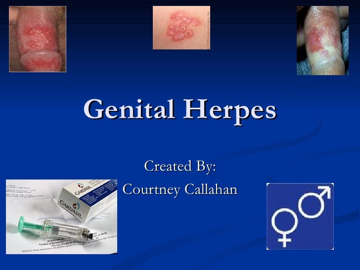 Stages of a Genital Herpes Outbreak - herpesmedication.org