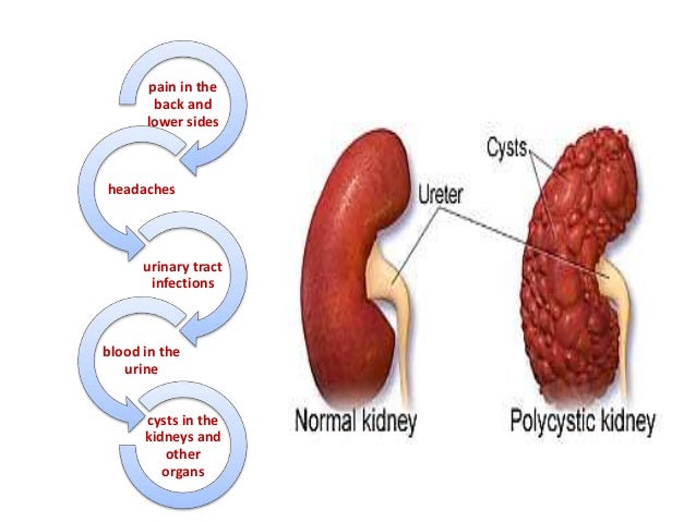peritoneal dialysis how long are you able to be on it