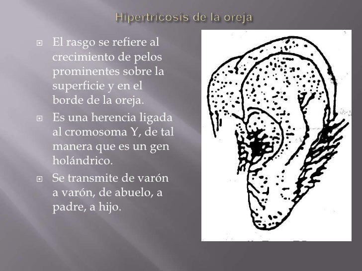 Inguinal el cambio de la pigmentación de la piel