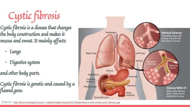 cystic fibrosis pku and the digestive cystic fibrosis pku and the digestive