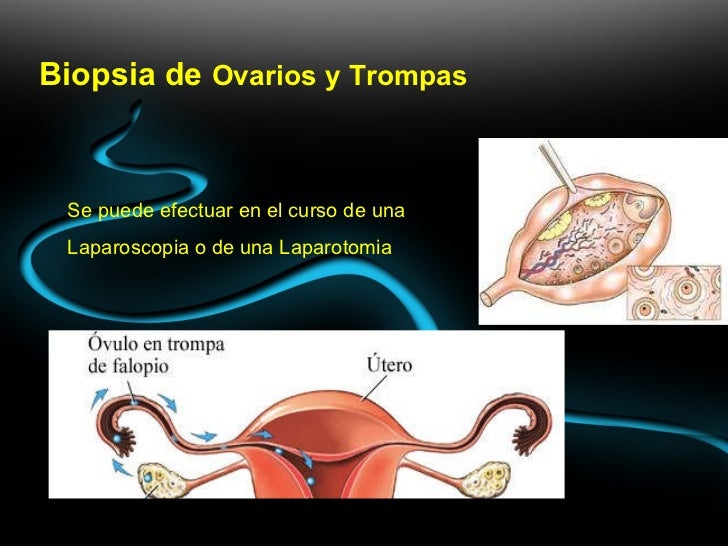 Exame de colposcopia com biopsia