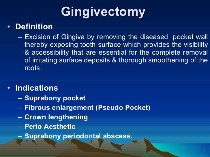 Gingivectomy