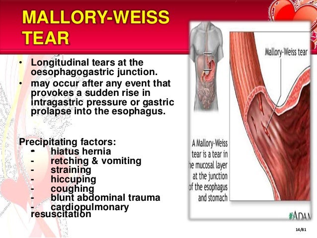 can you get pregnant with level 3 cervical most cancers