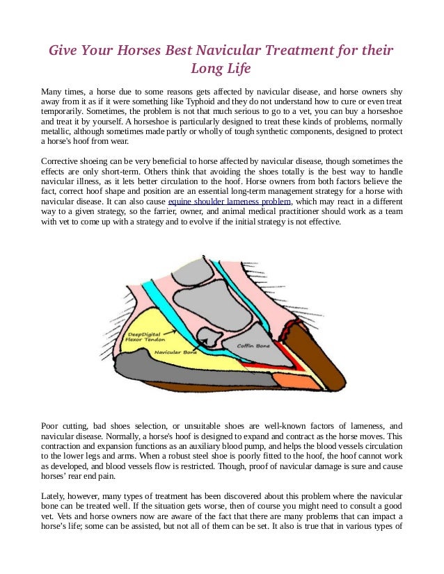 Accessory Navicular