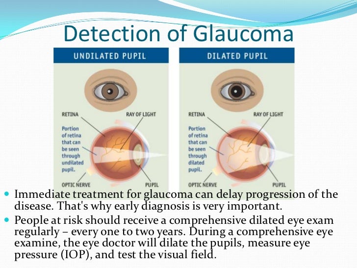 glaucoma diseases hypertension pigmentary