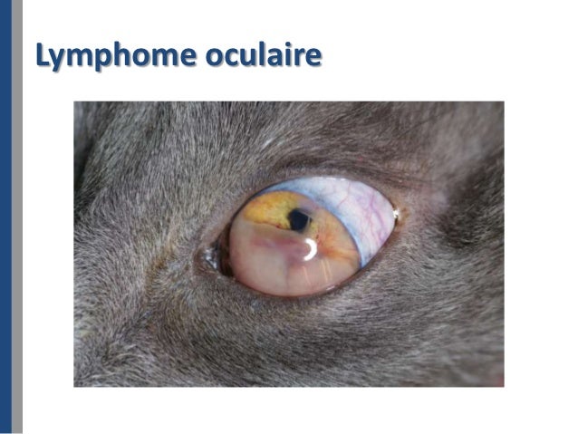 Lymphome Oculaire Traitement