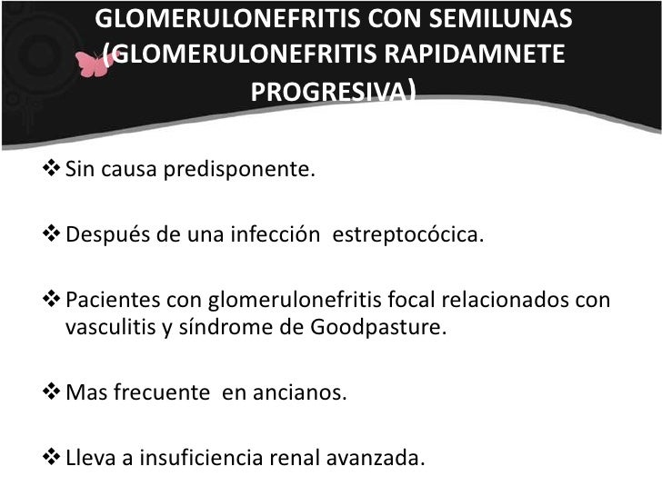 Glomerulonefritis