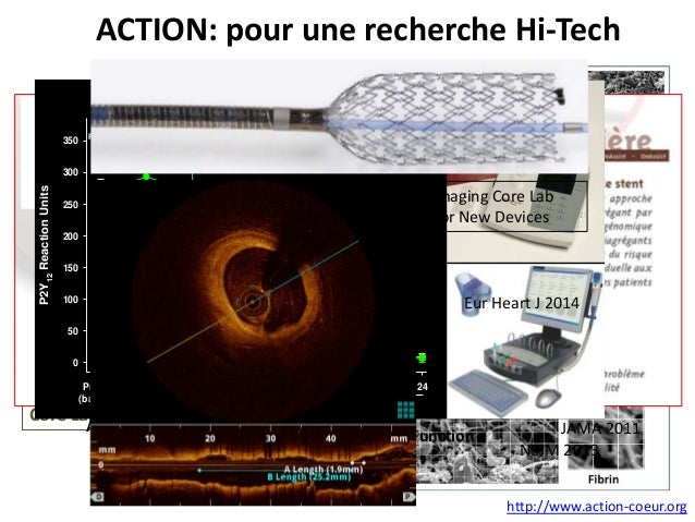 Rencontre recherche clinique