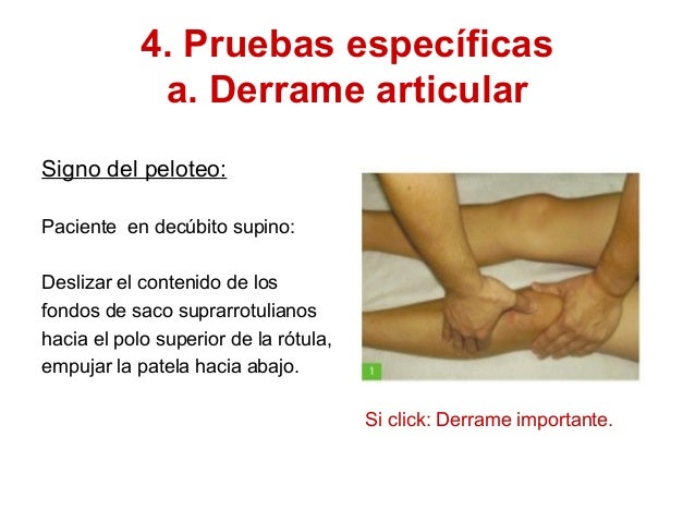 Gonalgia en ap