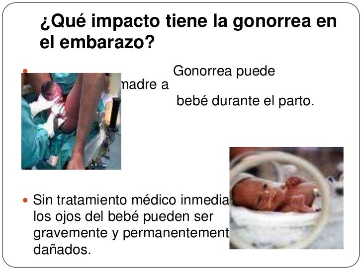 El dolor en la espalda y la parte inferior del vientre a los hombres