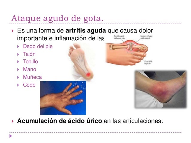 A mí 24 duele los riñones