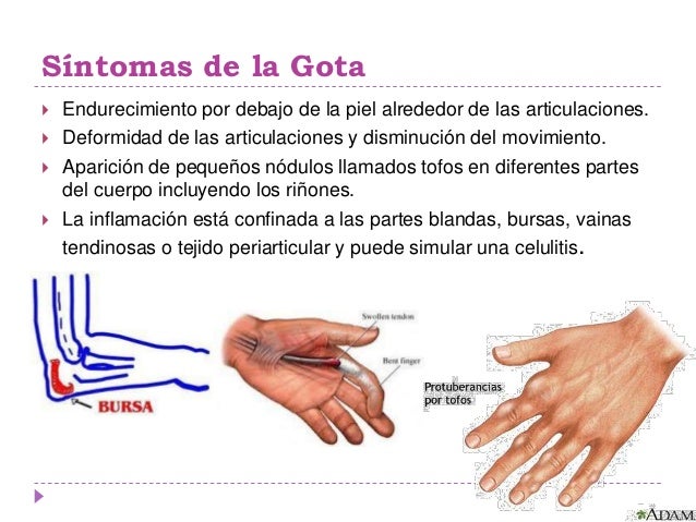 El dolor en los músculos laterales del cuello