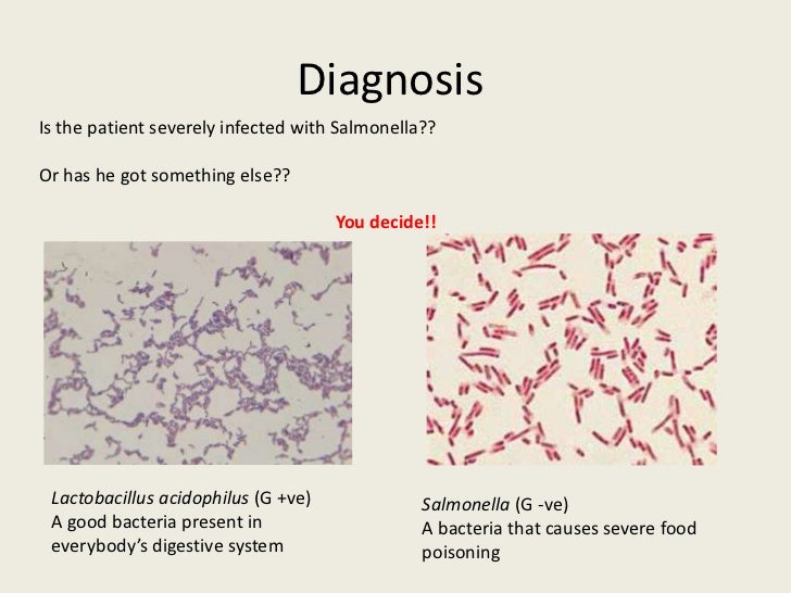 microbiology bacteria and fresh yogurt slide 2013 microbiology of yogurt fresh milk begins acquiring microbes from the very moment it leaves the cow what is the bacteria used in yogurt production a: the bacteria most commonly used to make yogurt are lactobacillus bulgaricus and streptococcus thermophilus 2. microbiology bacteria and fresh yogurt slide 2013 microbiology of yogurt fresh milk begins acquiring microbes from the very moment it leaves the cow what is the bacteria used in yogurt production a: the bacteria most commonly used to make yogurt are lactobacillus bulgaricus and streptococcus thermophilus 2.