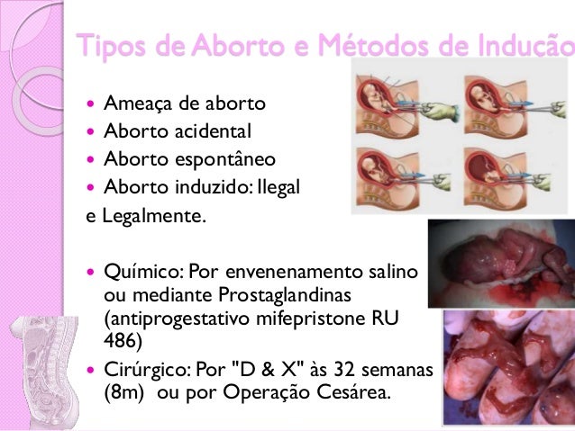 A alcoólicos sobre alcoolismo