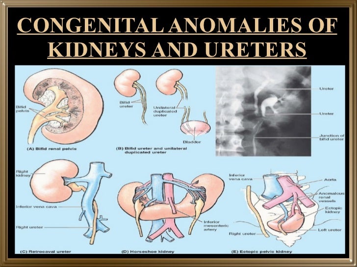 Gross structure of kidney and ureter