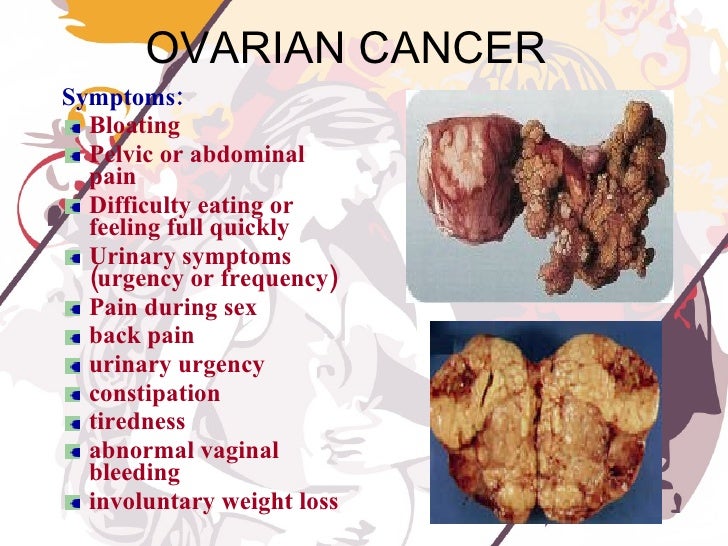 cervical cancer signs and symptoms early